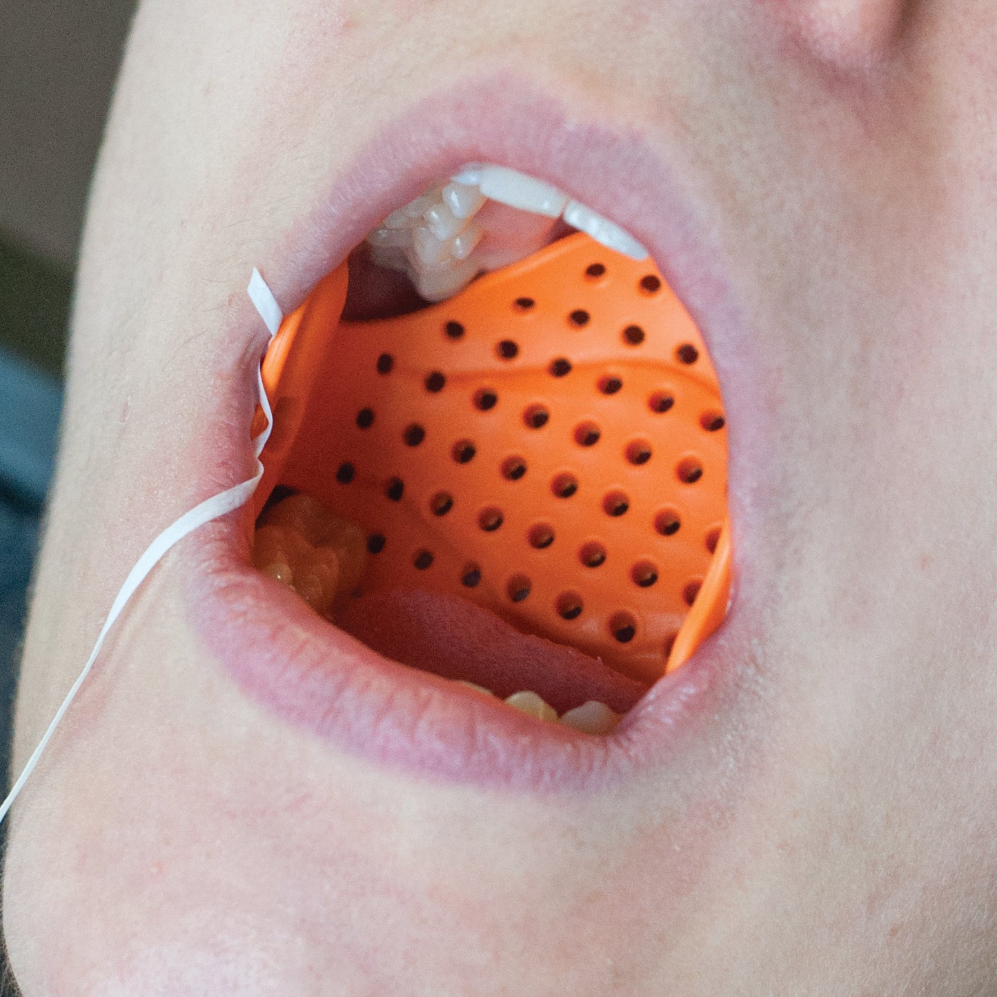 Airway Armor Kit Protector Bucal