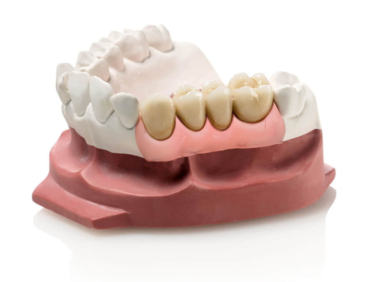Gingifast (Elastico/Rigido)