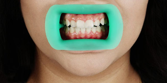 Cheek Retractor