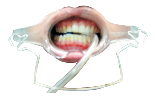 RETRACTOR DE LABIOS
