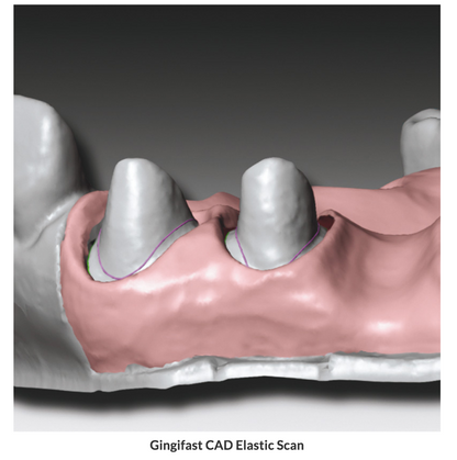 Gingifast CAD (Elastico/Rigido)