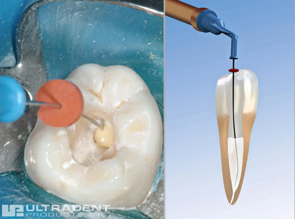 ENDO-EZE NAVITIP