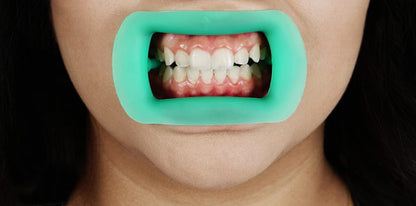 Cheek Retractor