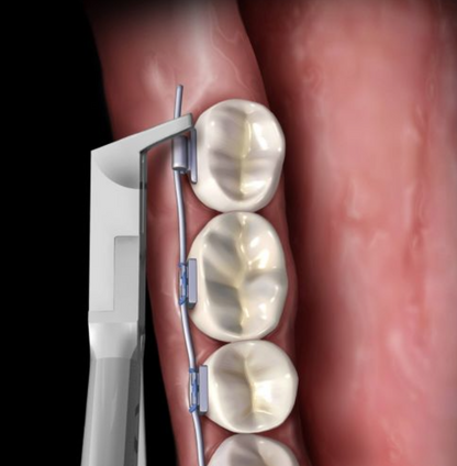 PINZA/ALICATE DE CORTE DISTAL DELGADA CON GOMA Y SEGURO HU-FRIEDY