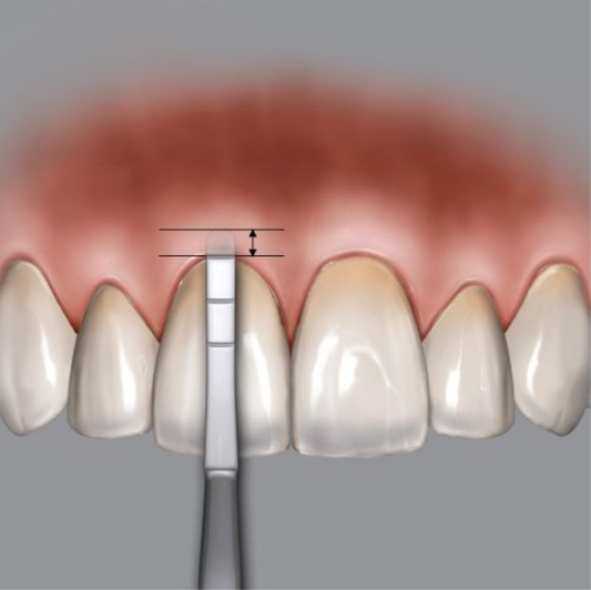 SONDA PARA CRESTA ALVEOLAR DR. CHU«S METALICA HU-FRIEDY