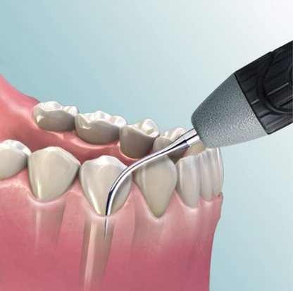 INSERTO ULTRASONICO 30K/SD10 UNIVERSAL MANGO GIRATORIO HU-FRIEDY